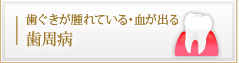 歯ぐきが腫れている・血が出る 歯周病